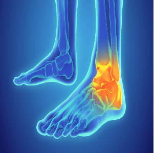 ankle replacement in indore