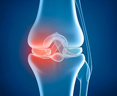 knee replacement surgeon in Indore