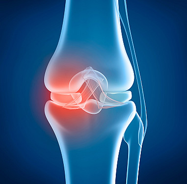 top knee replacement surgeon in Indore
